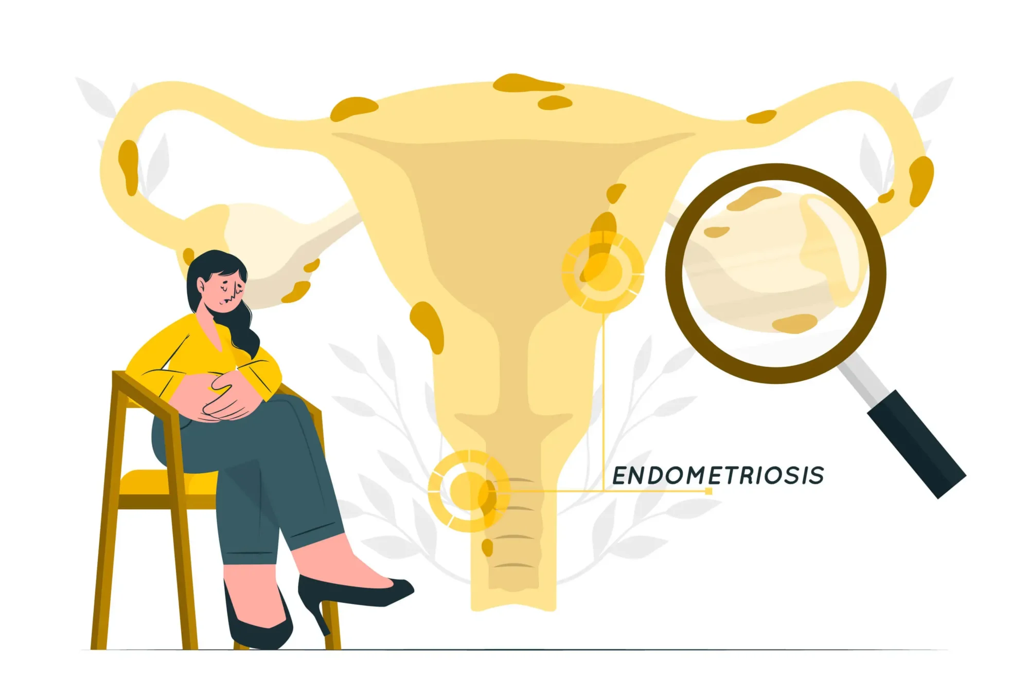 endometriosis